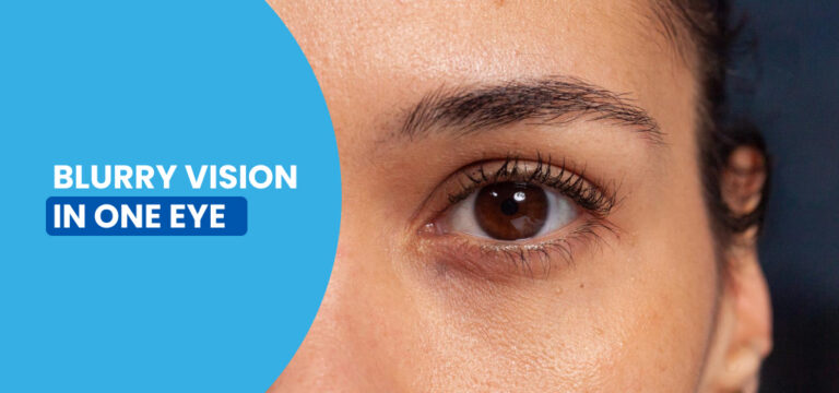Blurry Vision in One Eye: Causes, Symptoms, and When to Seek Care