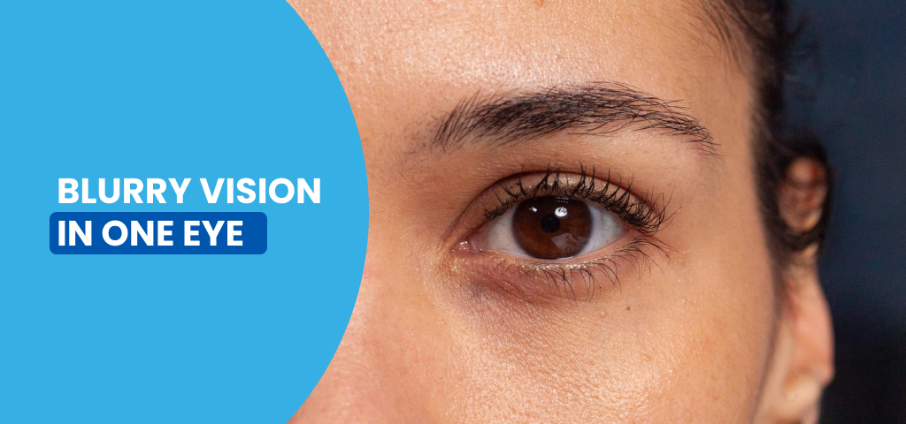 Blurry Vision in One Eye: Causes, Symptoms, and When to Seek Care